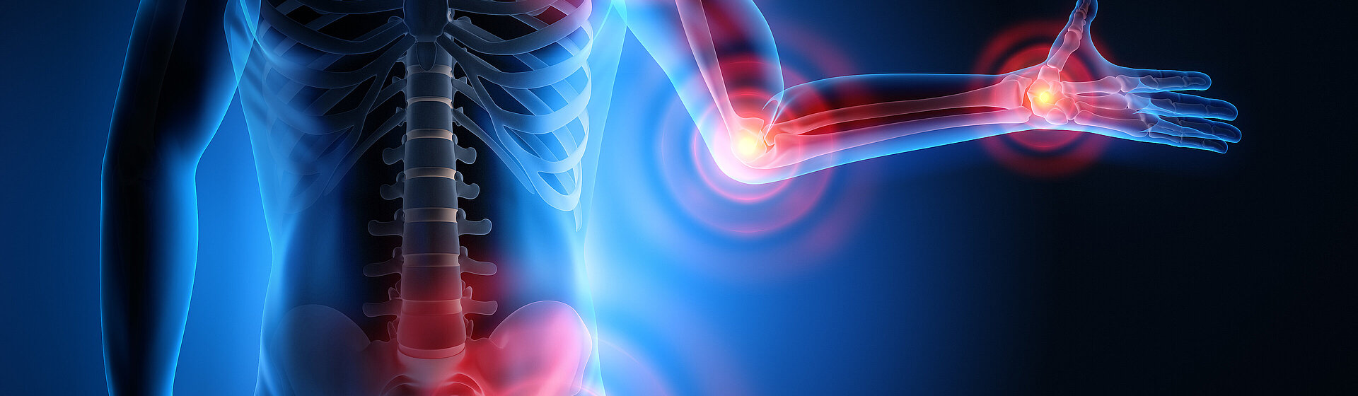 Arthrosis_joints_special_clinic_Sports_clinic_Hellersen_